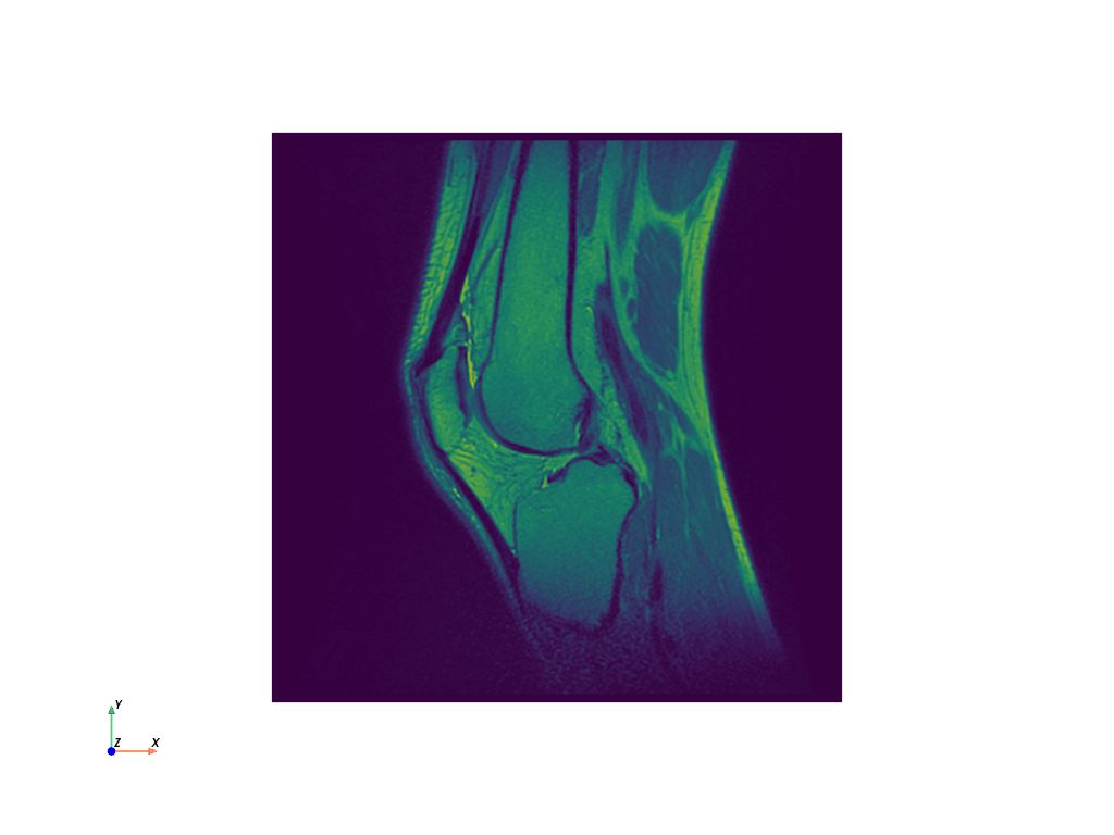 ../../../_images/pyvista-examples-downloads-download_knee-3c1adcad3357d35d_00_00.png
