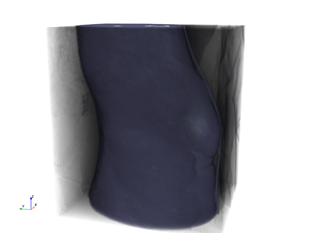 ../../../_images/pyvista-examples-downloads-download_knee_full-03161188a73148f7_00_00.png