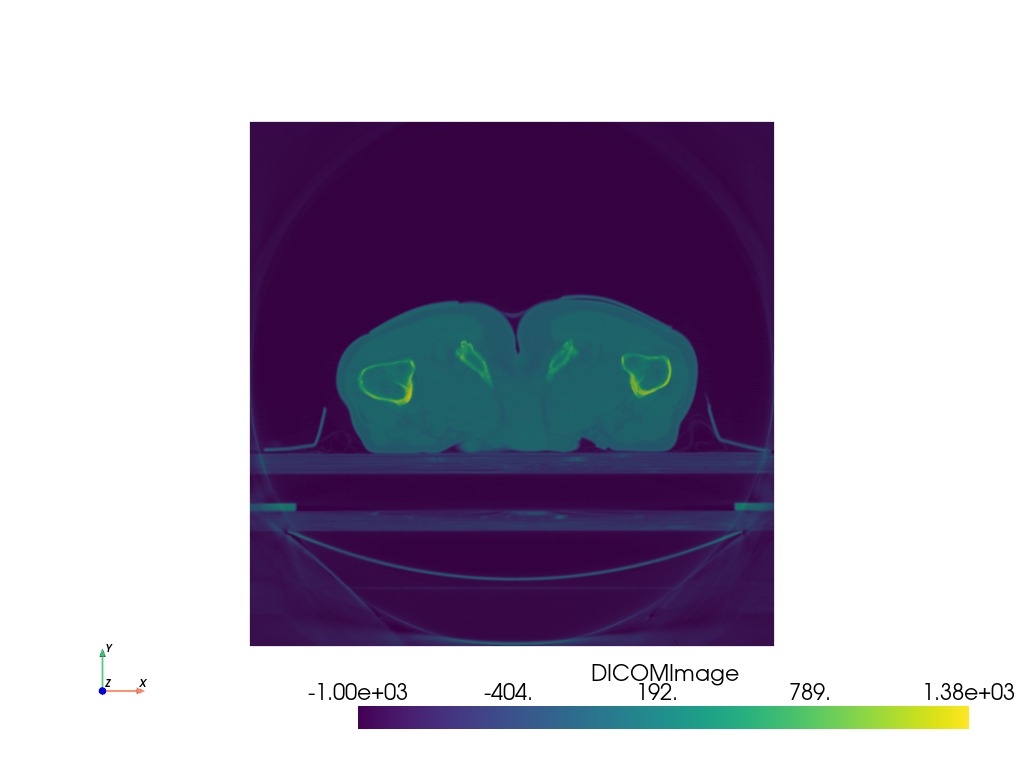 ../../../_images/pyvista-examples-downloads-download_prostate-2c6ca69db2a61e02_00_00.png