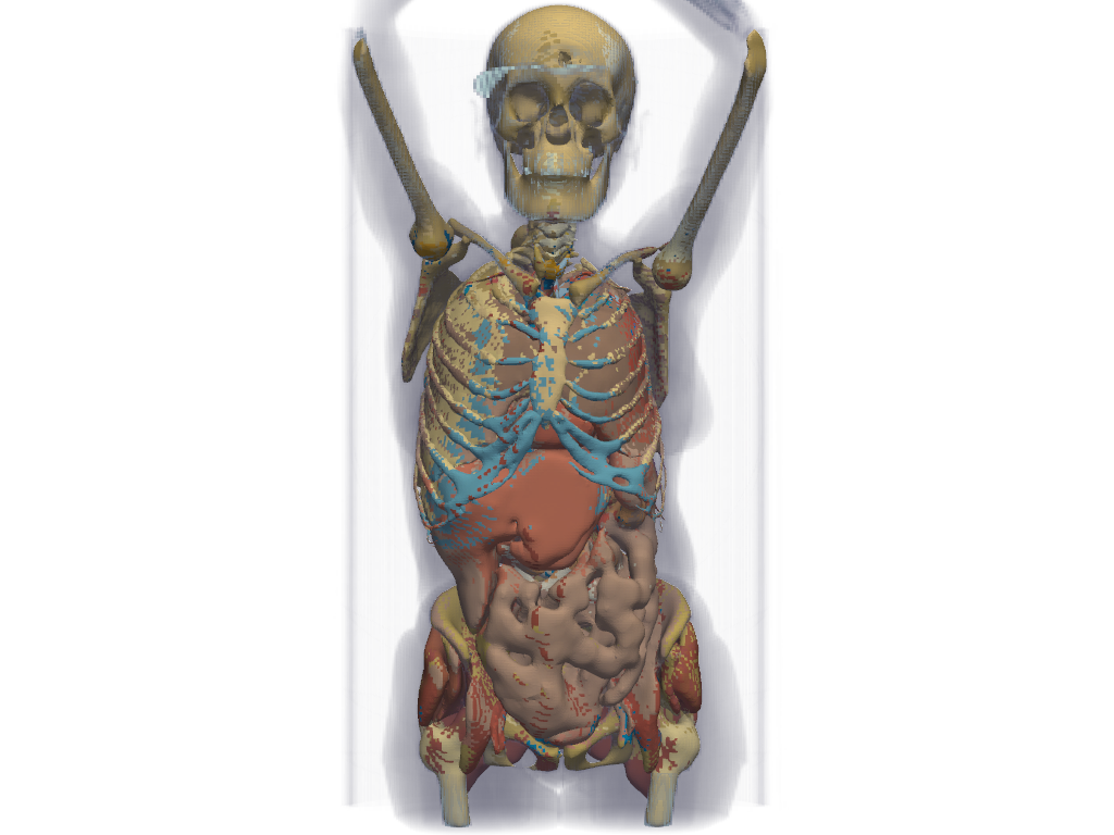 ../../../_images/pyvista-examples-downloads-download_whole_body_ct_female-51cf66df56b405fd_00_00.png
